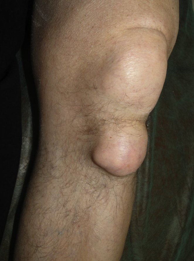 40v39n06-90226263fig1